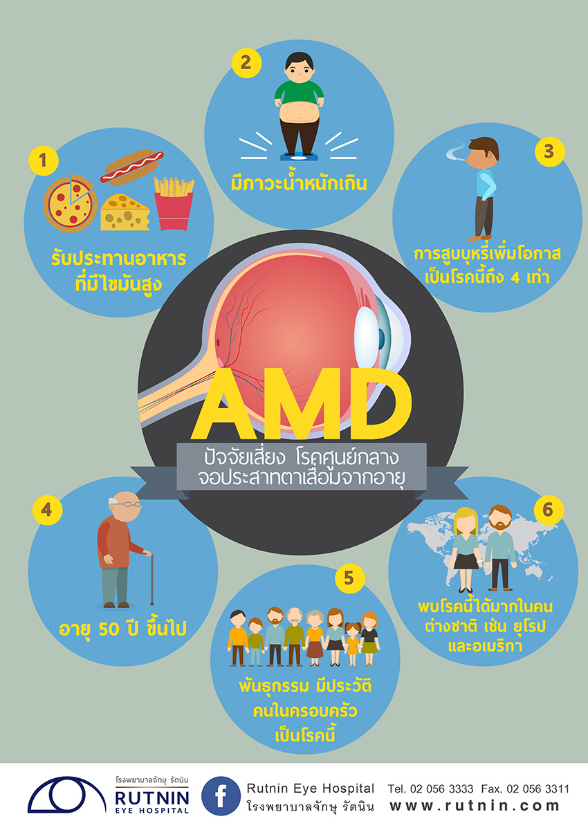ปัจจัยเสี่ยง AMD โรคศูนย์กลางจอประสาทตาเสื่อมจากอายุ