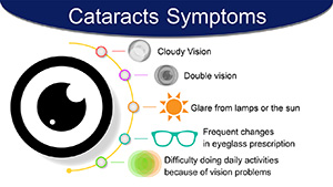 Cataracts symptoms