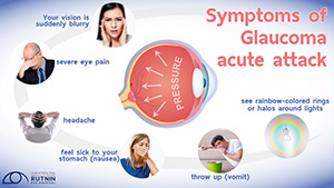 Symptoms of Glaucoma acute attack