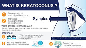 What is keratoconus ?