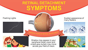 Retinal Detachment Symptoms