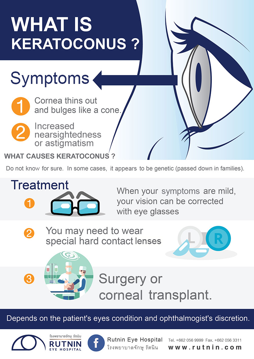 What is keratoconus ?