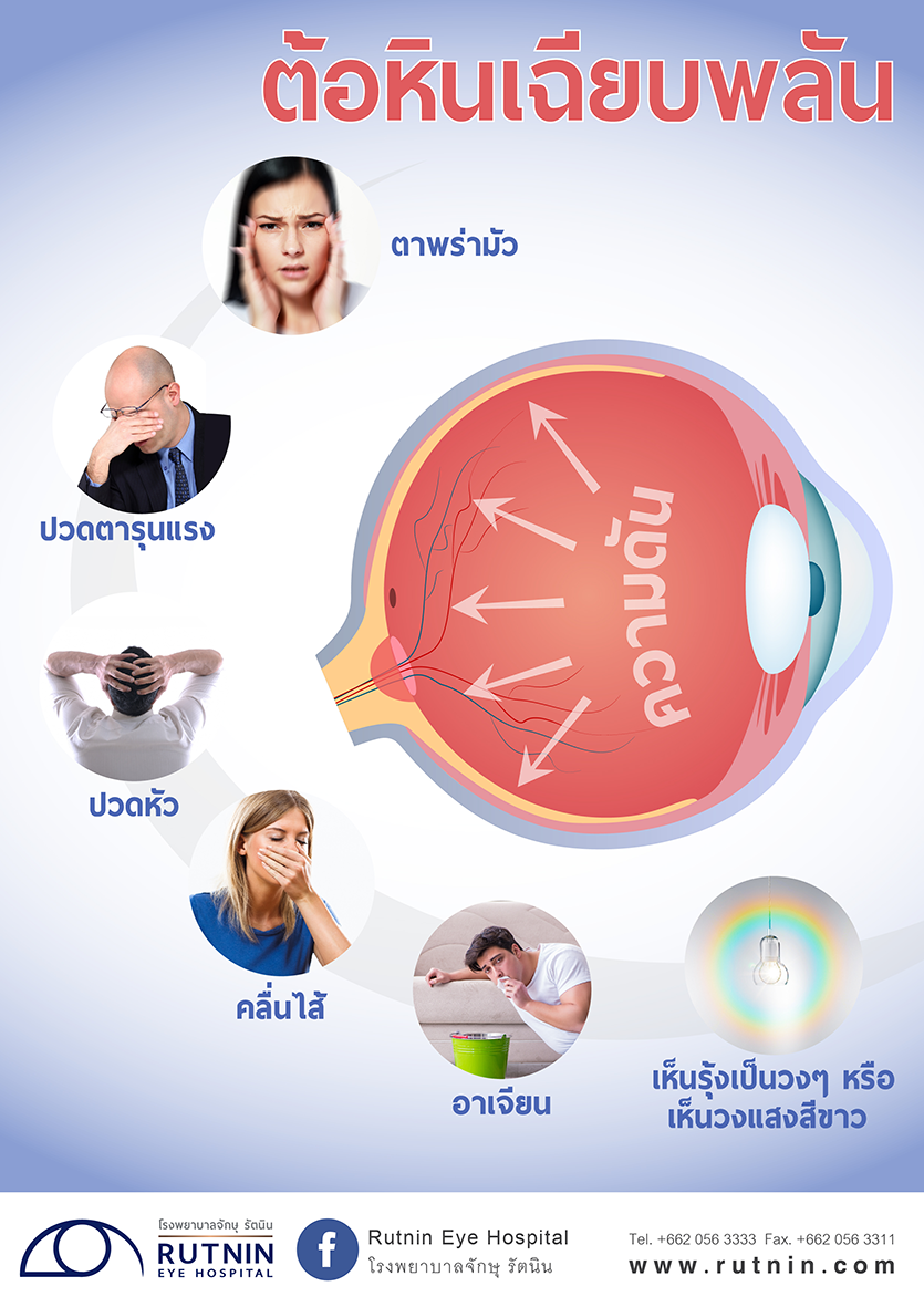 ต้อหินเฉียบพลัน