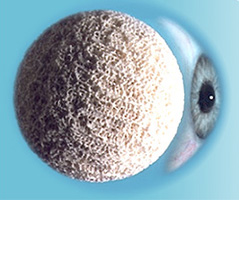 CORAL EYE IMPLANT